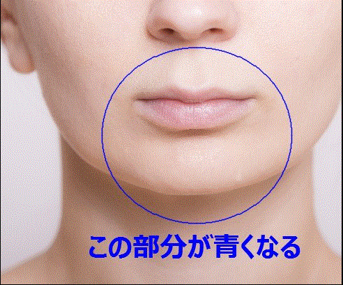 女性のひげ処理方法 あごひげの正しい処理方法 ノイス Noisu 女性特有のひげ 産毛 ケア